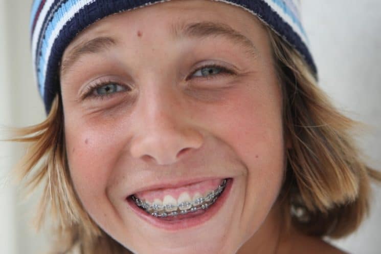 kid with braces